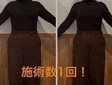 Y.M様(30代女性)